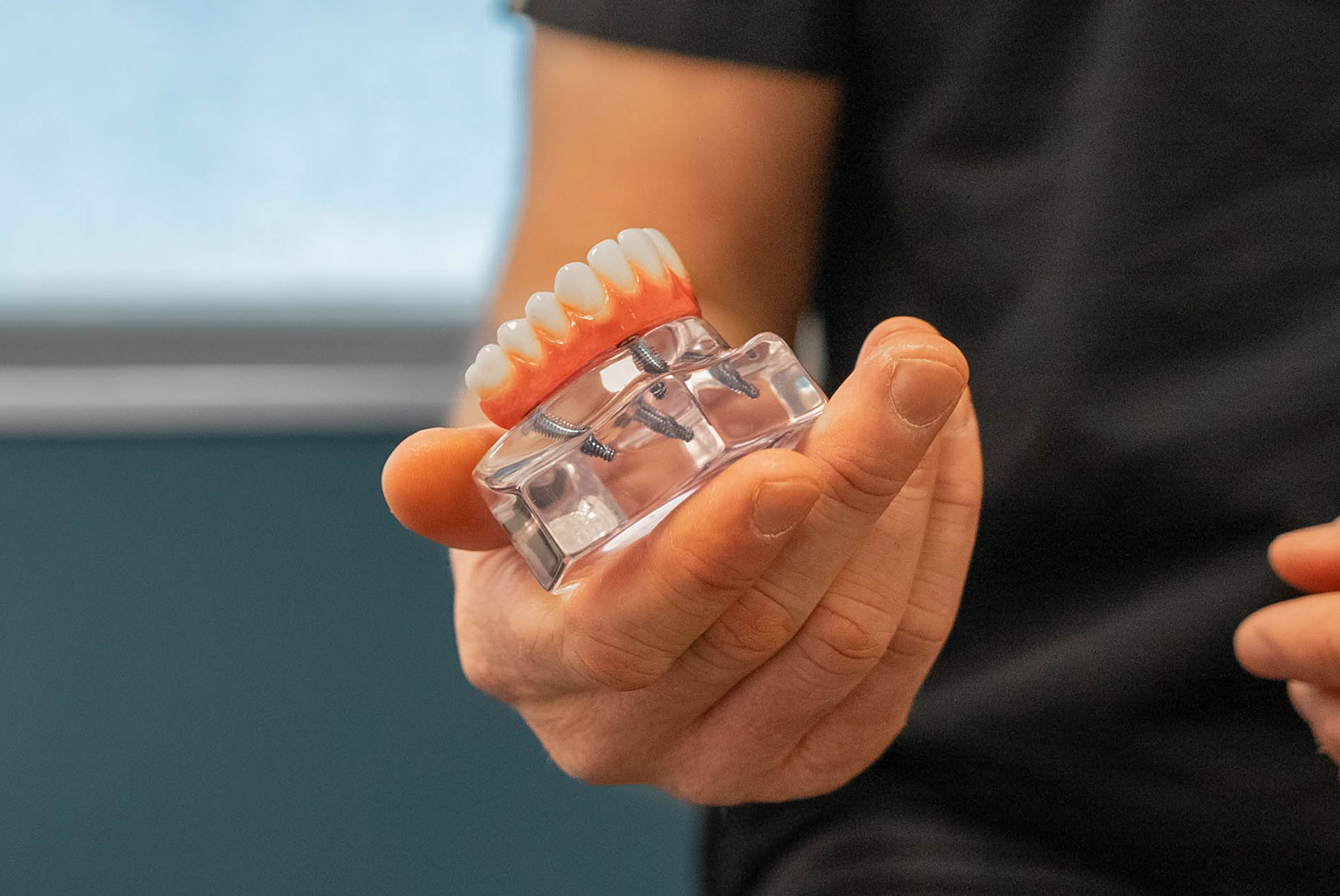 Dental Implants In Raleigh