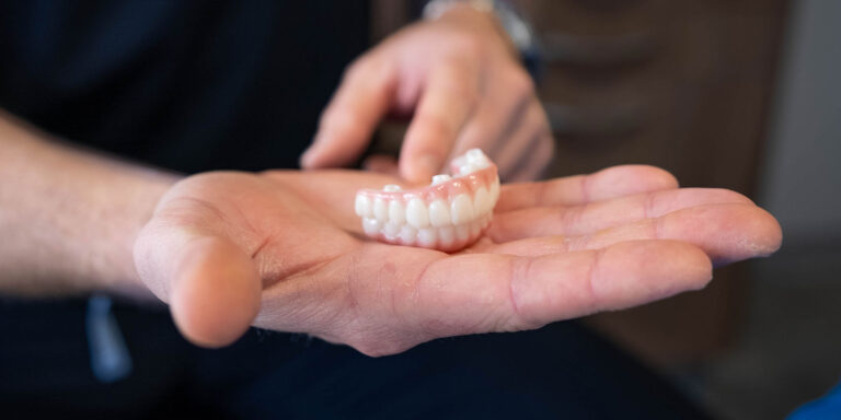 dental implants